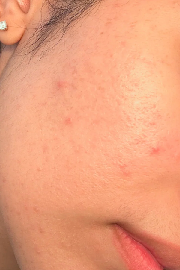 After